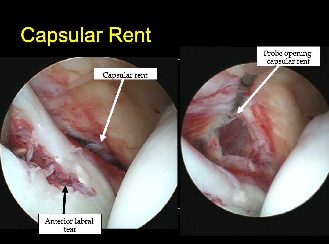 Figure 2 for case dislocation ( RID4770 )